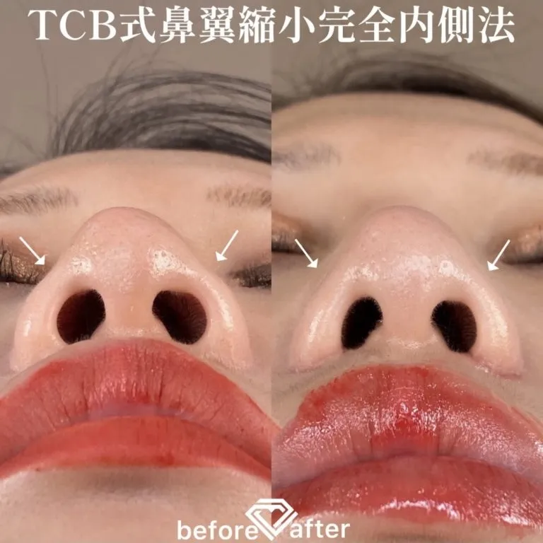 案例照片