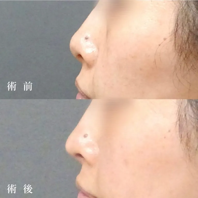 案例照片