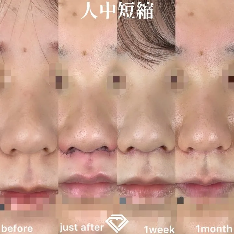 案例照片
